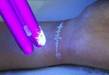 Cientistas criam tatuagem capaz de mudar de cor conforme níveis de açúcar no sangue