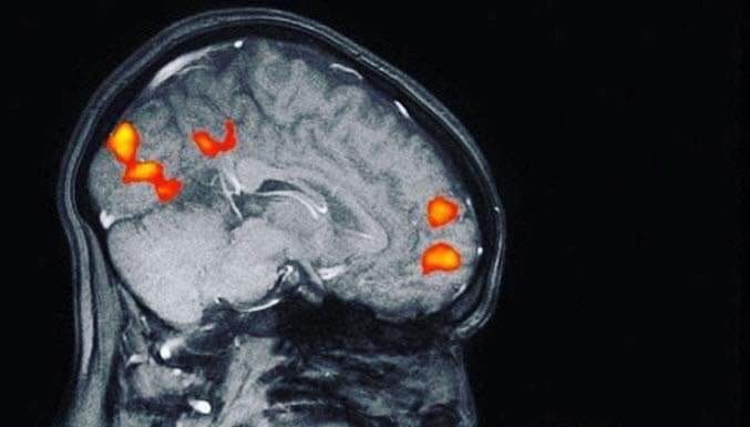 Exame mostra a ligação entre mãe e filho pela primeira vez no mundo