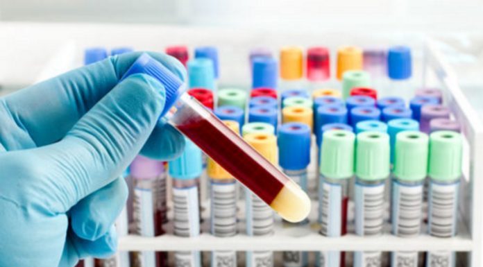 Exames de sangue , poderão detectar qualquer tipo de tumor precocemente .