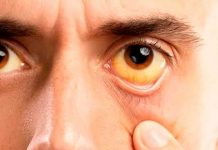 A hepatite é perigosa para a humanidade.