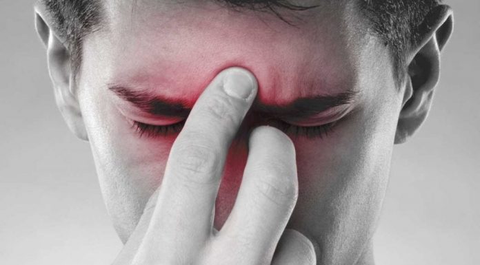 Remédios caseiros e naturais para sinusite.