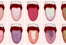 Mau gosto na boca?O que significa e que ação imediata deve ser tomada