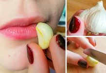 Remédios caseiros para herpes labial.