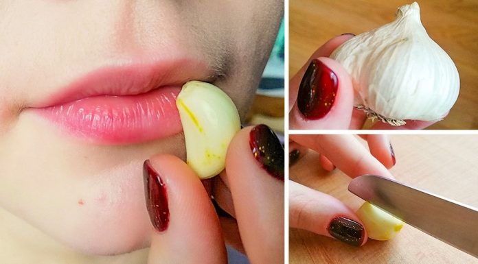 Remédios caseiros para herpes labial.