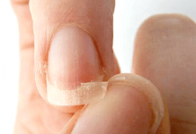 Por quê você tem unhas fracas? Saiba as causas e tire suas dúvidas!