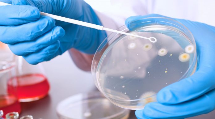 Com este remédio natural, você pode acabar com a bactéria Helicobacter Pylori.