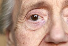 Alzheimer: saiba mais sobre a primeira doença neurodegenerativa.