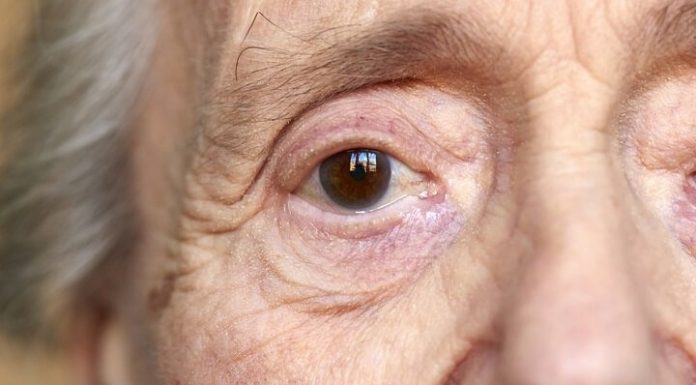 Alzheimer: saiba mais sobre a primeira doença neurodegenerativa.