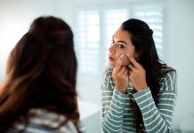 Espinhas no rosto: o que você precisa saber sobre elas