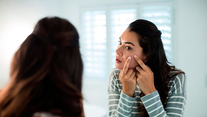 Espinhas no rosto: o que você precisa saber sobre elas