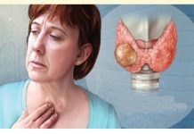 Esses são sinais de alerta de câncer de tireoide.