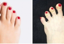 Dê uma olhada em seus pés e veja o que eles dizem sobre sua saúde.