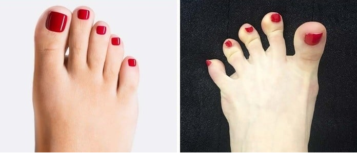 Dê uma olhada em seus pés e veja o que eles dizem sobre sua saúde.