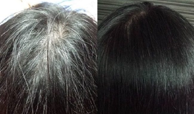 Batata Inglesa: Um ingrediente que resgata os cabelos brancos e os devolve à cor anterior.