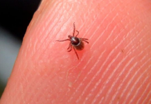 Aqui estão 3 dicas que todos devem saber para evitar picadas de carrapatos.