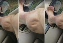 Você sente cãibras nas pernas? seu corpo quer te dizer algo. Preste atenção aos sinais.