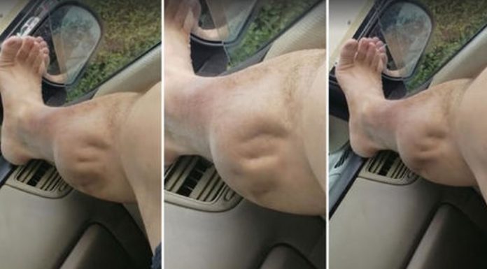 Você sente cãibras nas pernas? seu corpo quer te dizer algo. Preste atenção aos sinais.