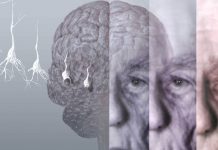 A degeneração causada pelo Alzheimer pode ser retardada?