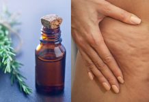 Álcool de alecrim: remove celulite, varizes e até dores musculares