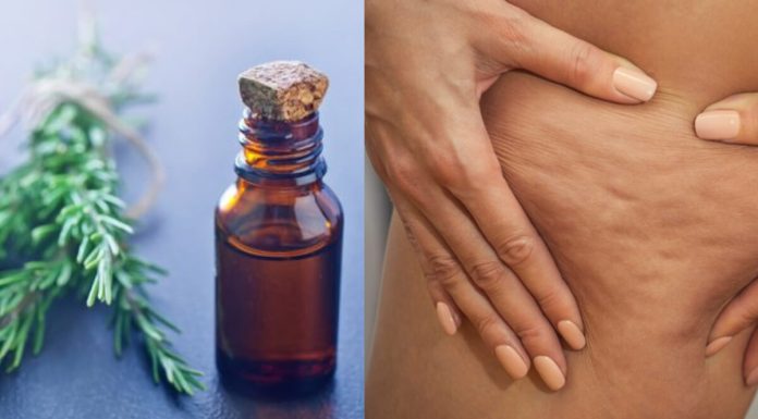 Álcool de alecrim: remove celulite, varizes e até dores musculares