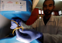 Jovem egípcio cria milhares de escorpiões e gera alta renda com a venda do veneno